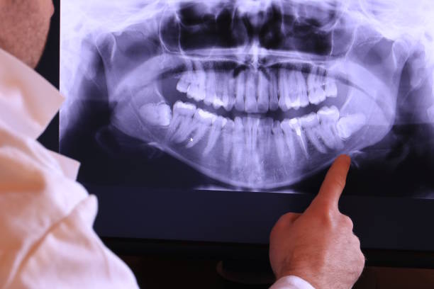 Best Emergency Root Canal Treatment in Madison Center, CT