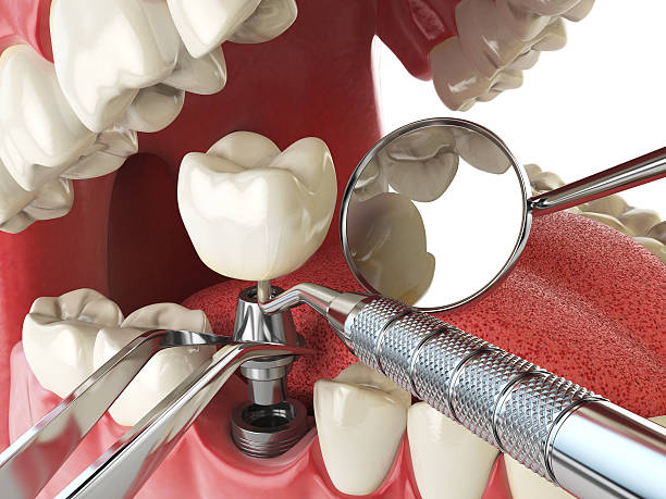 Best Broken or Cracked Tooth Emergency Dentist in Madison Center, CT